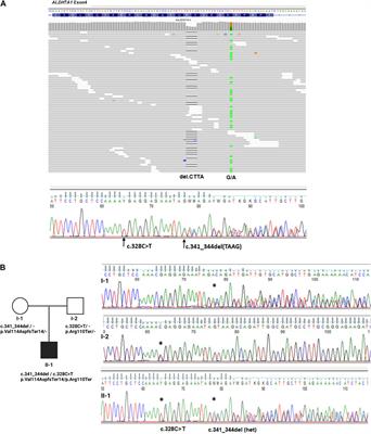 Case report: Early (molecular) diagnosis is the clue: report on ALDH7A1 deficiency in newborns